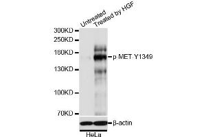Immunofluorescence analysis of U2OS cells using Phospho-MET-Y1349 antibody (ABIN5969922). (c-MET antibody  (pTyr1349))