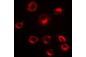 Immunofluorescent analysis of Serpin A10 staining in HepG2 cells. (SERPINA10 antibody)