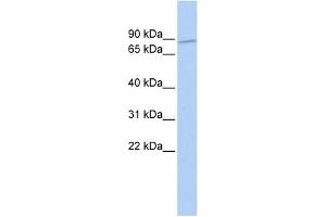 WB Suggested Anti-ZNF800 Antibody Titration:  0. (ZNF800 antibody  (N-Term))