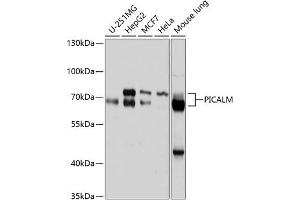 Western blot analysis of extracts of various cell lines, using PICALM antibody (ABIN6132898, ABIN6145606, ABIN6145607 and ABIN6214874) at 1:1000 dilution. (PICALM antibody  (AA 290-460))
