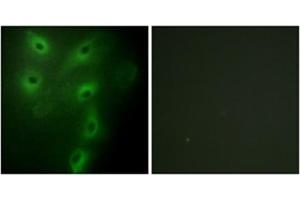 Immunofluorescence analysis of HeLa cells, using TRIM59 Antibody . (TRIM59 antibody  (Internal Region))