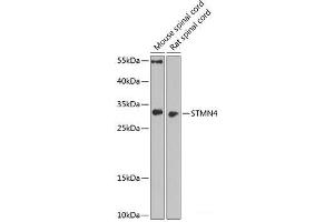Western blot analysis of extracts of various cell lines using STMN4 Polyclonal Antibody at dilution of 1:1000. (STMN4 antibody)