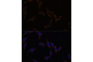Immunofluorescence (IF) image for anti-Regulator of G-Protein Signaling 4 (RGS4) (AA 1-100) antibody (ABIN7269898)