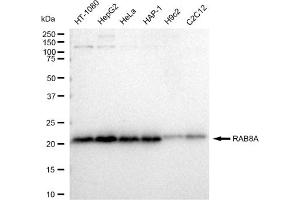 anti-RAB8A, Member RAS Oncogene Family (RAB8A) antibody