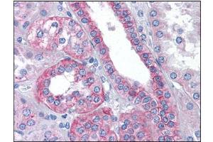 Human Kidney: Formalin-Fixed, Paraffin-Embedded (FFPE) (Flotillin 2 antibody  (C-Term))