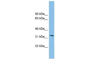WB Suggested Anti-ZPBP2 Antibody Titration: 0.