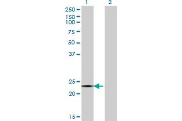 CITED4 antibody  (AA 131-184)