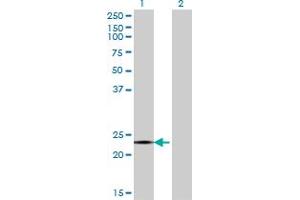 Western Blot analysis of CITED4 expression in transfected 293T cell line by CITED4 monoclonal antibody (M08), clone 4F6.