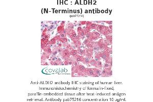 Image no. 1 for anti-Aldehyde Dehydrogenase 2 Family (Mitochondrial) (ALDH2) (N-Term) antibody (ABIN5693475) (ALDH2 antibody  (N-Term))