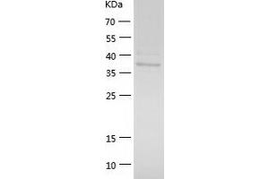 Western Blotting (WB) image for Alcohol Dehydrogenase 5 (Class III), chi Polypeptide (ADH5) (AA 1-374) protein (His tag) (ABIN7121768) (ADH5 Protein (AA 1-374) (His tag))