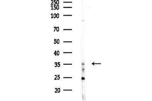 anti-Small Nuclear RNA Activating Complex, Polypeptide 3, 50kDa (SNAPC3) (C-Term) antibody