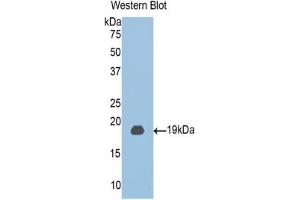 Western blot analysis of the recombinant protein. (CLIC4 antibody  (AA 104-253))