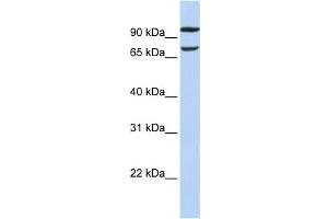 Western Blotting (WB) image for anti-Family with Sequence Similarity 38, Member B (FAM38B) antibody (ABIN2459321) (PIEZO2 antibody)