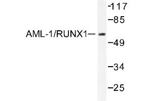 Image no. 1 for anti-Runt-Related Transcription Factor 1 (RUNX1) antibody (ABIN271868) (RUNX1 antibody)