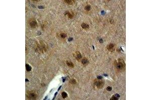 Immunohistochemical analysis of GAP43 staining in mouse brain formalin fixed paraffin embedded tissue section. (GAP43 antibody)