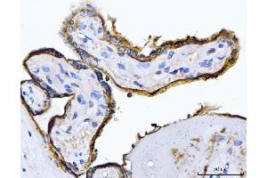IHC analysis of ALPP using anti-ALPP antibody (ABIN7602772). (PLAP antibody  (C-Term))