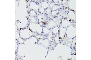 Immunohistochemistry of paraffin-embedded mouse lung using S100 Rabbit pAb (842) at dilution of 1:100 (40x lens). (S100A9 antibody  (AA 1-114))
