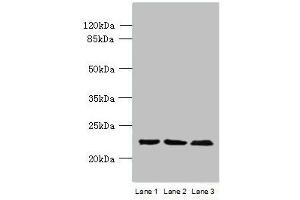 Western blot All lanes: WDYHV1 antibody at 6 μg/mL Lane 1: Mouse heart tissue Lane 2: MCF-7 whole cell lysate Lane 3: U251 whole cell lysate Secondary Goat polyclonal to Rabbit IgG at 1/10000 dilution Predicted band size: 24, 17 kDa Observed band size: 24 kDa (WDYHV1 antibody  (N-Term))