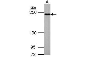 WB Image Sample (30 ug of whole cell lysate) A: Hep G2 , 5% SDS PAGE antibody diluted at 1:500 (SHROOM2 antibody  (C-Term))