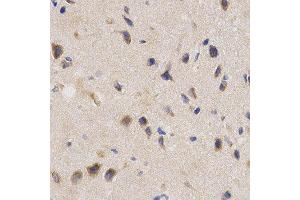 Immunohistochemistry (IHC) image for anti-Protein Phosphatase 2A Activator, Regulatory Subunit 4 (PPP2R4) (AA 1-323) antibody (ABIN1682265)