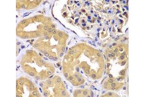 Immunohistochemistry of paraffin-embedded Human kidney using LZTR1 Polyclonal Antibody at dilution of 1:100 (40x lens).