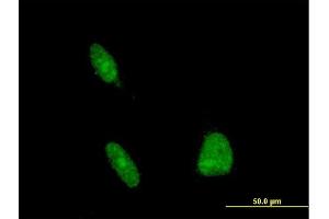 Immunofluorescence of monoclonal antibody to ERCC1 on HeLa cell.