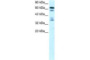 Human Brain; WB Suggested Anti-ZNF512 Antibody Titration: 0. (ZNF512 antibody  (Middle Region))