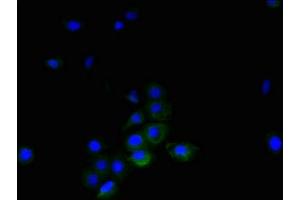 Immunofluorescent analysis of A431 cells using ABIN7173806 at dilution of 1:100 and Alexa Fluor 488-congugated AffiniPure Goat Anti-Rabbit IgG(H+L) (TNFSF14 antibody  (AA 1-239))