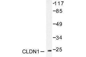 Image no. 1 for anti-Claudin 1 (CLDN1) antibody (ABIN265358) (Claudin 1 antibody)