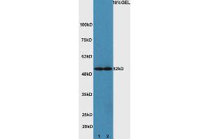 Lane 1: mouse heart lysates Lane 2: mouse brain lysate probed with Rabbit Anti-ATG4D Polyclonal Antibody, Unconjugated (ABIN752473) at 1:300 overnight at 4 °C. (ATG4D antibody  (AA 381-474))