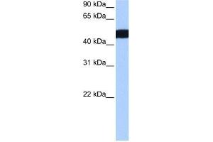 Western Blot showing CROCCL2 antibody used at a concentration of 1-2 ug/ml to detect its target protein. (CROCCP3 antibody  (N-Term))