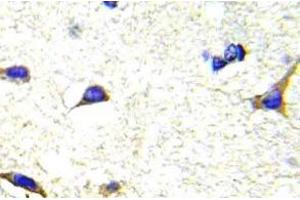 Immunohistochemistry (IHC) analyzes of LIMK1/2 antibody in paraffin-embedded human brain tissue. (LIM Domain Kinase 1 antibody)