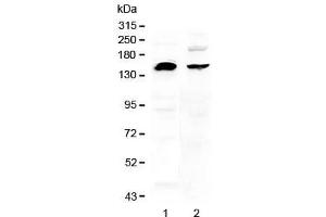 Western blot testing of human 1) U-87 MG and 2) MDA-MB-453 cell lysate with NEDD4 antibody at 0. (NEDD4 antibody)