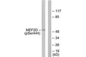 Western blot analysis of extracts from HepG2 cells treated with forskolin 40nM 30', using MEF2D (Phospho-Ser444) Antibody. (MEF2D antibody  (pSer444))