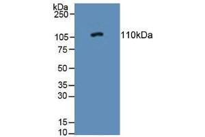 Figure. (PTPRN antibody  (AA 368-575))
