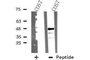 Western blot analysis of extracts from COS7 cells, using TSSC1 antibody. (TSSC1 antibody)