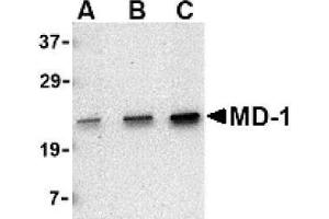 Image no. 1 for anti-Lymphocyte Antigen 86 (LY86) (C-Term) antibody (ABIN265131) (LY86 antibody  (C-Term))