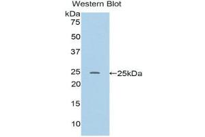 Western Blotting (WB) image for anti-RalA Binding Protein 1 (RALBP1) (AA 192-380) antibody (ABIN1176607) (RALBP1 antibody  (AA 192-380))
