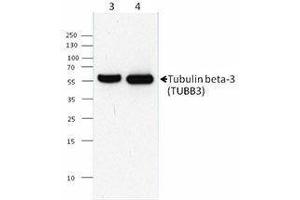 Western Blotting (WB) image for anti-Tubulin, beta 3 (TUBB3) antibody (ABIN2665447) (TUBB3 antibody)