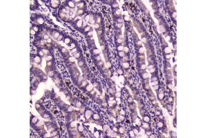 Immunohistochemistry (IHC) image for anti-Insulin-Like Growth Factor 2 Receptor (IGF2R) (AA 424-529) antibody (ABIN5693085)