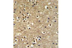 Formalin fixed and paraffin embedded brain tissue reacted with ETS2 Antibody (Center) followed by peroxidase conjugation of the secondary antibody and DAB staining. (ETS2 antibody  (Middle Region))