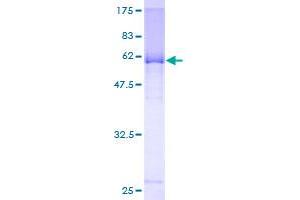 Potassium Channel Tetramerisation Domain Containing 9 (KCTD9) (AA 1-389) protein (GST tag)