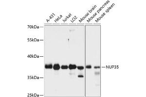 Western blot analysis of extracts of various cell lines, using NUP35 antibody (ABIN6129527, ABIN6144960, ABIN6144961 and ABIN6216505) at 1:3000 dilution. (NUP35 antibody  (AA 1-326))