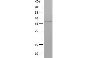 Western Blotting (WB) image for Deafness, Autosomal Dominant 5 (DFNA5) (AA 1-152) protein (His-IF2DI Tag) (ABIN7282199) (DFNA5 Protein (AA 1-152) (His-IF2DI Tag))