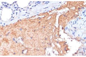 Immunohistochemistry of paraffin-embedded Mouse lung using APOA1 Polyclonal Antibody at dilution of 1:100 (40x lens). (APOA1 antibody)