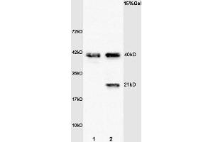 L1 rat brain lysates L2 human colon carcinoma lysates probed with Anti- Syndecan 4 Polyclonal Antibody, Unconjugated (ABIN681793) at 1:200 overnight at 4 °C. (SDC4 antibody  (AA 101-198))