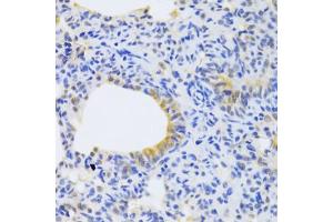 Immunohistochemistry of paraffin-embedded rat lung using MRPS30 Antibody (ABIN5973453) at dilution of 1/100 (40x lens). (MRPS30 antibody)