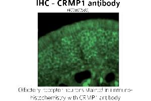 Image no. 1 for anti-GABA Transporter 1 (GAT1) (C-Term) antibody (ABIN346940) (SLC6A1 antibody  (C-Term))