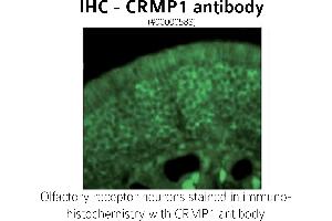 Image no. 1 for anti-GABA Transporter 1 (GAT1) (C-Term) antibody (ABIN346940)