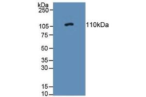 PTPRN 抗体  (AA 368-575)